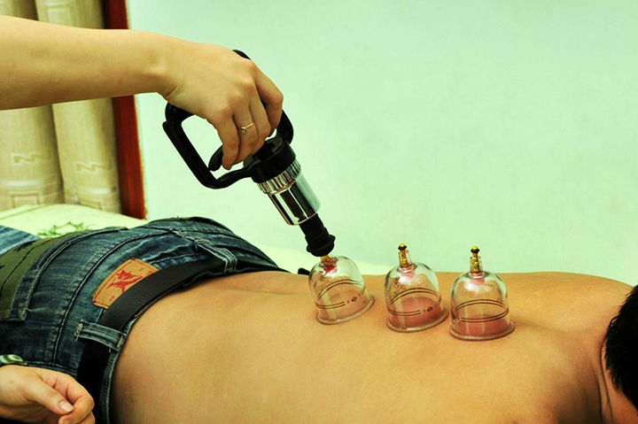 Ống giác hơi không dùng lửa Duy Thành